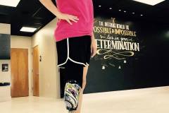Michelle-showing-off-her-custom-prosthetic